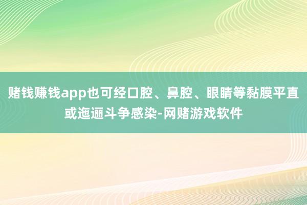 赌钱赚钱app也可经口腔、鼻腔、眼睛等黏膜平直或迤逦斗争感染-网赌游戏软件